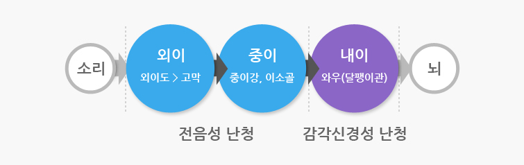 소리는 외이(외이도>고막) 중이(중이강이소골)를 거처 내이(와우:달팽이관) 내이(와우:달팽이관)를 거처 뇌에 전달된다 여기서 외이와 중이 사이에서 문제가 발생하는 것인 전용성 난청이며 내이에서 발생하는 난청이 감음신경성 난청이다.